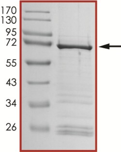 Sino Biological&nbsp;Recombinant Human CDK11A/CDC2L2 Protein (GST Tag)